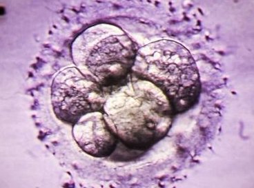 苏州做试管多少钱？重点花费主要是这几个部分！